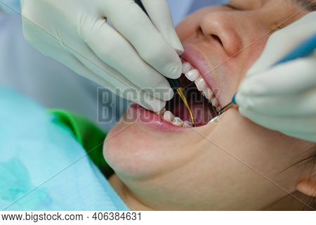 Woman Is Undergoing Dental Treatment And Specialist Is Doing Check Up And Curing Teeth Patient.