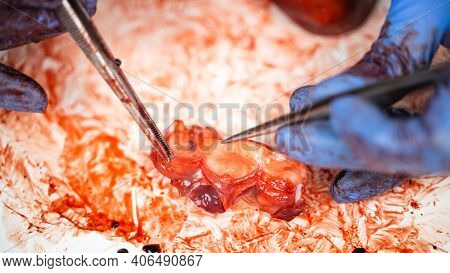 Scientist Showing The Semilunar Valves Of A Fresh Dissected Pig Heart With Scalpel And Tweezers.