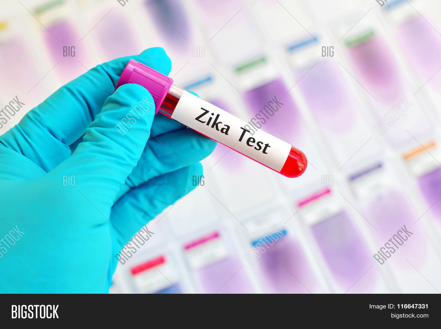 Zika Virus Test Image & Photo (Free Trial) Bigstock