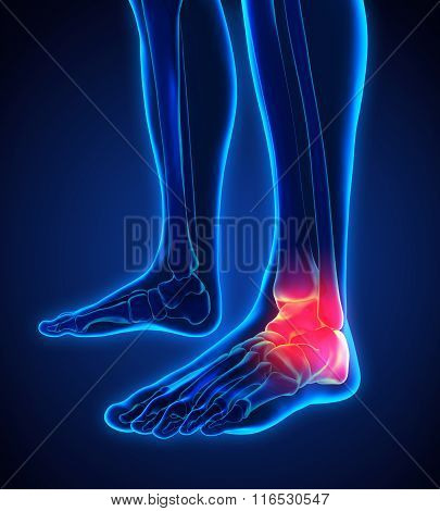 Painful Ankle Illustration