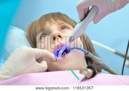 Stomatologist. Dental health. Female dentist curing a child patient in doctor's consulting room. Pediatric dentist.