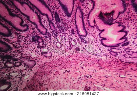 Cell Microscopic- Pyloric Division Stomach