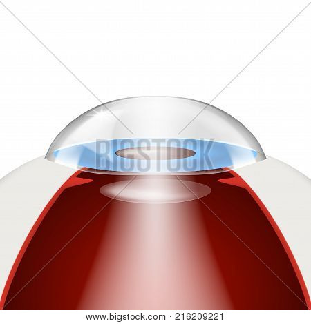 Simple Intraocular Lenses Implantation Model. Eps10 Vector