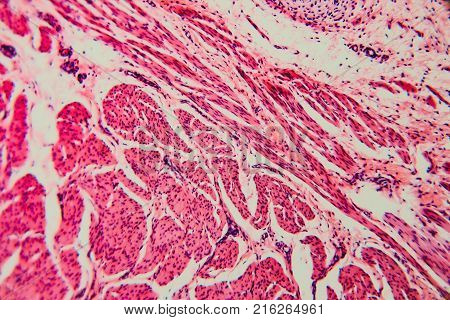 Cell Microscopic- Pyloric Division Stomach