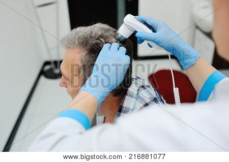 baldness. doctor examines an elderly man hair using special equipment - trihoskopa
