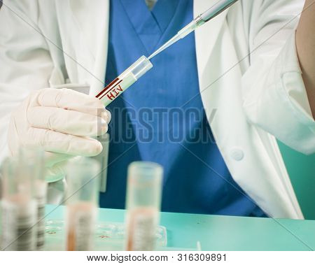 Specialist Make A Hiv Test, Aids Test In The Laboratory