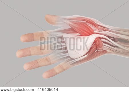 X-ray Muscle Hand Pain From Office Syndrome