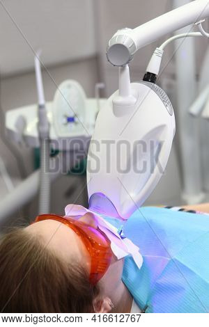 Teeth Whitening In A Dental Clinic. Young Woman Whitens Her Teeth With Special Equipment. Bleaching