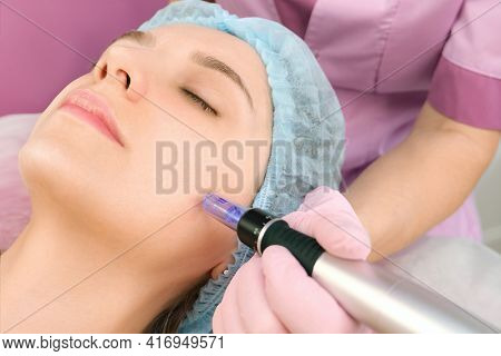 Needle Mesotherapy. Cosmetologist Performs Needle Mesotherapy On A Womans Face. Beautiful Woman Rece