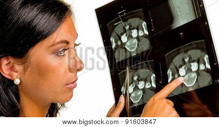 a doctor holding the x-ray image of a disc infiltration in hand.