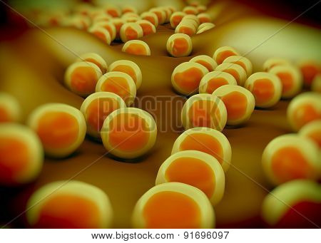 superbug or Staphylococcus aureus (MRSA) bacteria