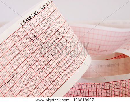 Close up of an electrocardiogram analysing for heart disease problem.