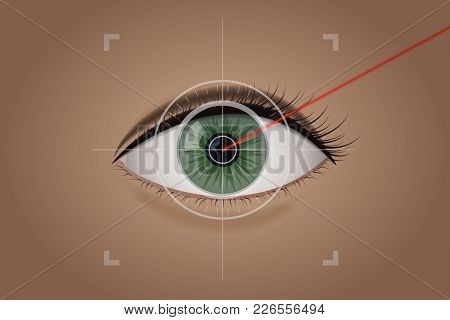 Vision Correction By A Laser Beam. Ophthalmologist Vector Illustration. Green The Human Eye. Medical