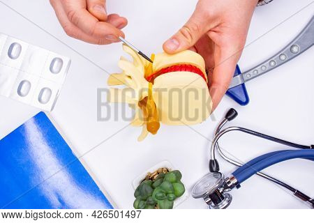 Pathology Of Ganglion Of The Spinal Cord As Cause Of Back Pain. A Neurologist Or Traumatologist Show