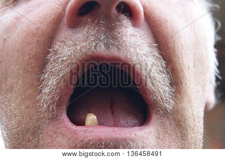 The Mouth of the person with sick teeth.Open mouth without teeth