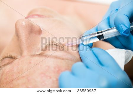 Beautician makes biorevitalization to young woman. The cosmetic procedures for the face. Beauty treatments in the spa salon. Facial Skin Care.