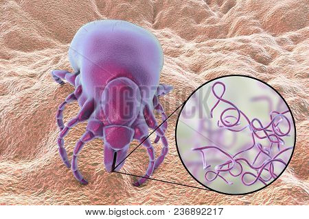 Lyme Disease Bacteria, Borrelia Burgdorferi, Transmitted By Ixodes Tick, 3d Illustration