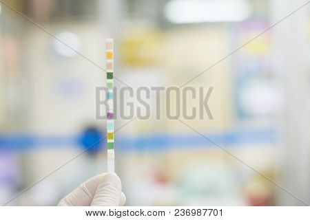 Close Up Urine Strip Testing In Hand Scinetist.