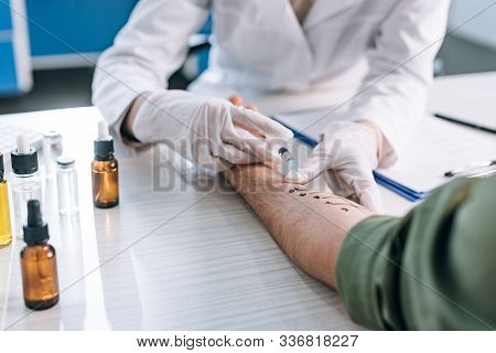 Selective Focus Of Allergist Holding Syringe Near Marked Hand Of Patient