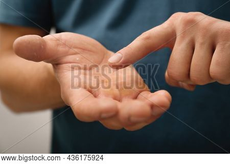 Man Applying Cream On Hand For Calluses Treatment Against Grey Background, Closeup