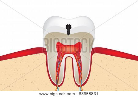 Crop of tooth
