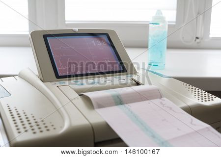 Printing of cardiogram report coming out from Electrocardiograph in labour ward. Fetal monitor