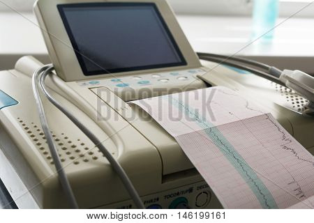 Printing of cardiogram report coming out from Electrocardiograph in labour ward. Fetal monitor