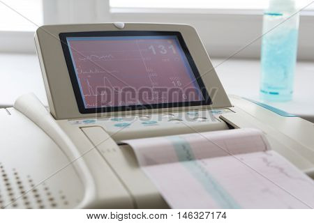 Printing of cardiogram report coming out from Electrocardiograph in labour ward. Fetal monitor