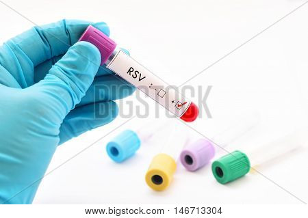 Blood sample with RSV (Respiratory Syncytial Virus) positive