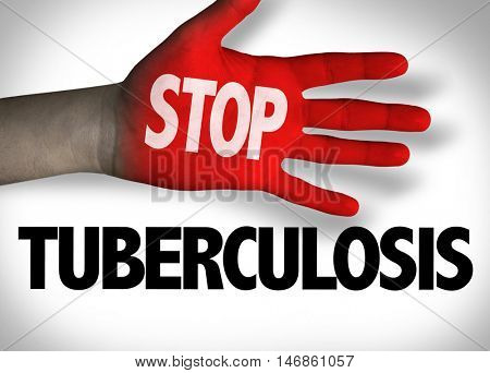 Stop Tuberculosis
