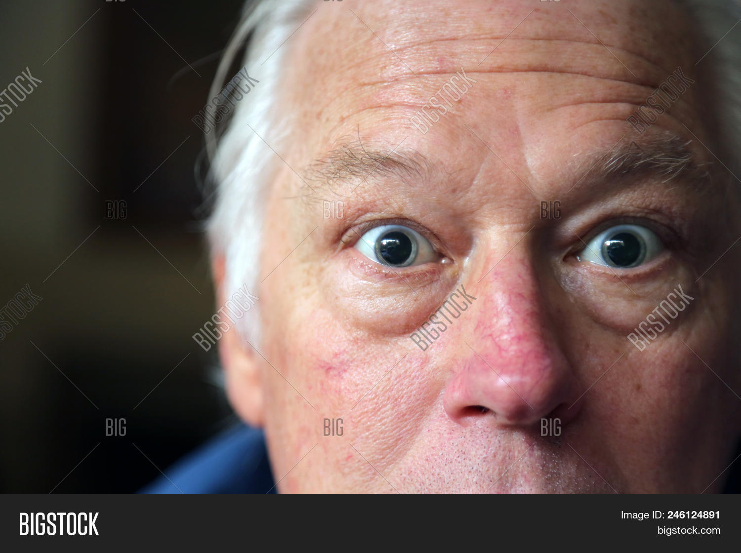 A Guide To Living With Glaucoma