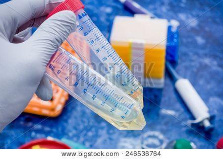 Liquid Culture Of Bacteria In Test Tubes. The Scientist Holds In His Hand Two Test Tubes With A Cult