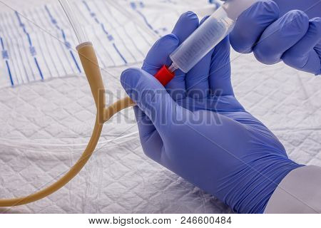 Nurse Inflates Urinary Catheter Bulb With Leg Drainage Bag On Sterile Field