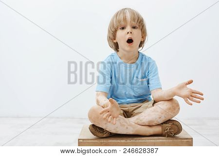 Studio Shot Of Impressed Curious Blond Child With Vitiligo Sitting With Crossed Feet And Dropping Ja