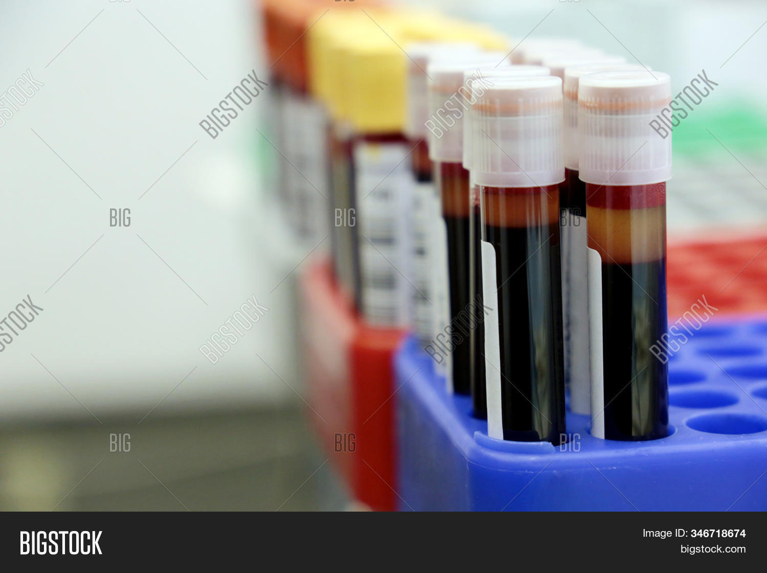Vials Blood Medical Image & Photo (Free Trial) Bigstock