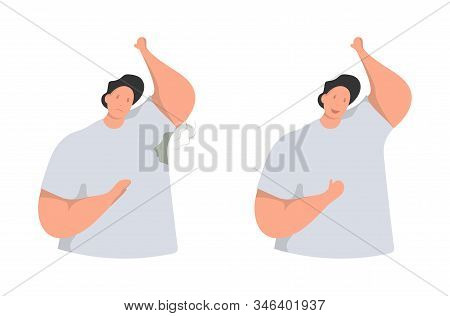 Wet Armpits. Smelly, Sweaty Stains On Male Clothes. Hyperhidrosis People, Sweat Spots Prevention. Ve