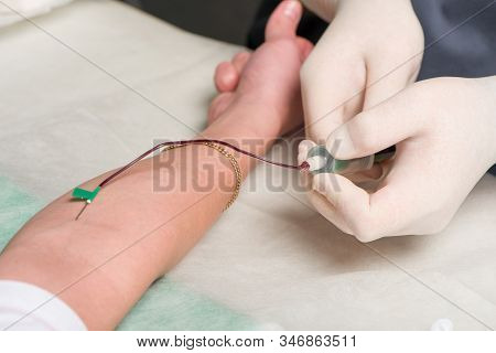 Hands In Latex Medical Gloves Make Vein Puncture In Area Of Ulnar Bend Of Patient S Hand