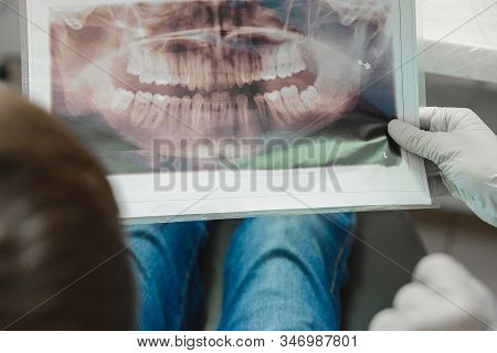 An Orthodontist Doctor Shows The Boy An X-ray Of His Teeth.