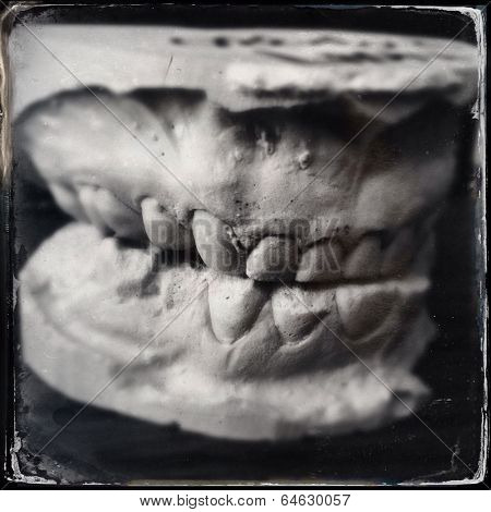Instagram style image of plaster teeth model