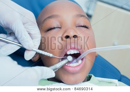 Close up of boy having his teeth examined by a dentist