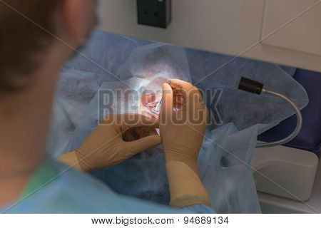 Ophthalmology femto lasik operation