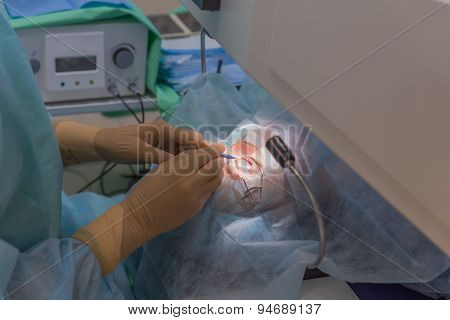 Ophthalmology femto lasik operation
