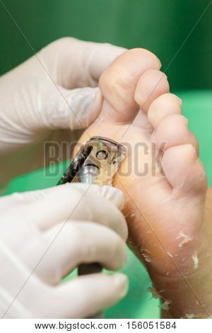 Pedicure  procedure in the beauty salon.  emover calluses on the feet. Foot care.