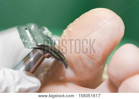 Pedicure  procedure in the beauty salon.  emover calluses on the feet. Foot care.