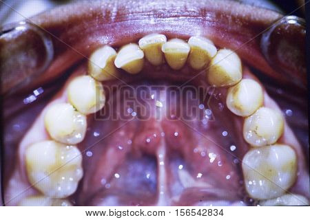 Dentists Dental Teeth Photo