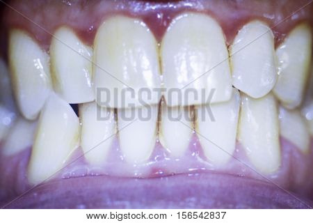 Dentists Dental Teeth Photo