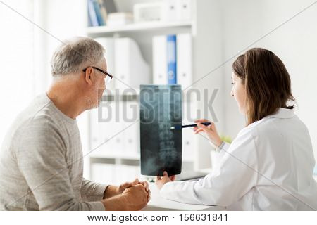 medicine, healthcare, surgery, radiology and people concept - doctor showing x-ray of spine to senior man at hospital
