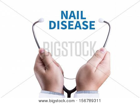 Nail Disease Fungus Infection On Nails Hand, Finger With Onychomycosis.