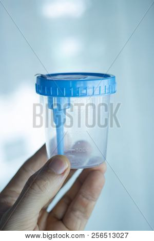 Urine Sample Test Cup