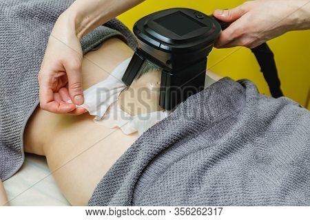 Woman Getting Cryolipolysis Fat Treatment Procedure In Beauty Salon